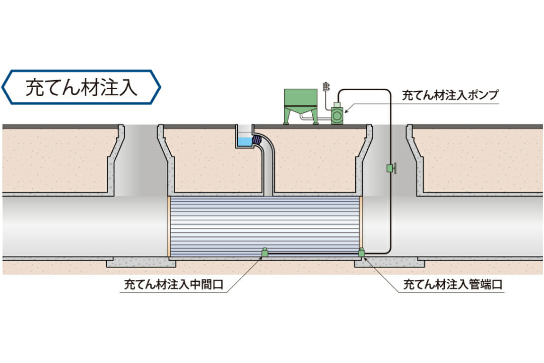 充てん材注入